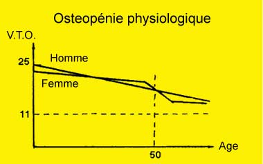 Courbe de l'osteopénie chez l'homme et la femme