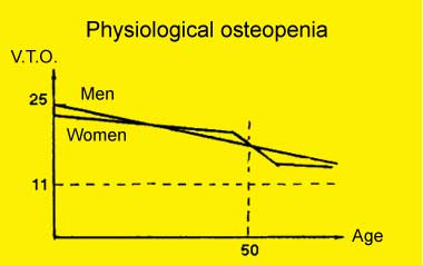 Courbe de l'osteopénie chez l'homme et la femme