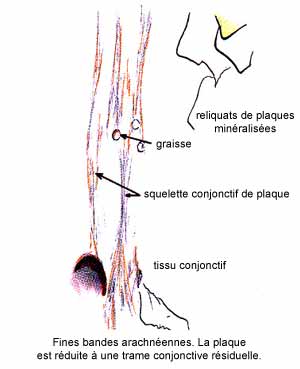 Tissu conjonctif